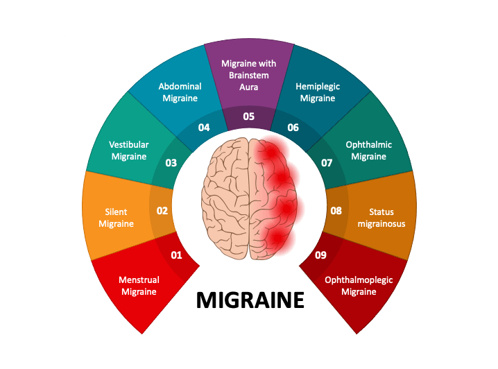 migraine relief